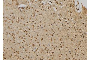ABIN6276672 at 1/100 staining Mouse brain tissue by IHC-P. (PTPN22 Antikörper  (C-Term))