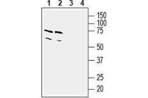 Western blot analysis of mouse (lanes 1 and 3) and rat (lanes 2 and 4) brain lysates: - 1,2. (TBXA2R Antikörper  (3rd Intracellular Loop))