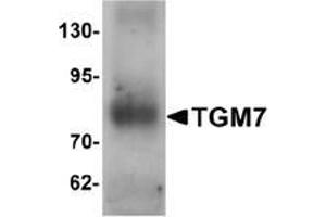 Western blot analysis of TGM7 in human lung tissue lysate with TGM7 Antibody  at 1 μg/ml. (Transglutaminase 7 Antikörper  (Middle Region))