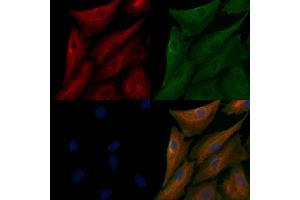 ABIN6262787 and ABIN6266575 staining  cells by IF/ICC.