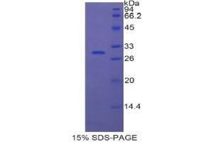 SDS-PAGE analysis of Human ETFa Protein. (Electron-Transfer-Flavoprotein, alpha Polypeptide (ETFA) Peptid)
