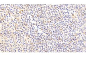 Immunohistochemistry (IHC) image for anti-Hemopoietic Cell Kinase (HCK) (AA 2-526) antibody (ABIN7443947)