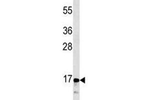 Western Blotting (WB) image for anti-Calcitonin-Related Polypeptide alpha (CALCA) (AA 56-84) antibody (ABIN3030254)