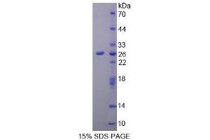 SDS-PAGE (SDS) image for Ribonuclease L (2',5'-Oligoisoadenylate Synthetase-Dependent) (RNASEL) (AA 358-583) protein (His tag) (ABIN1099437)