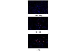 Immunofluorescence (Cultured Cells) (IF (cc)) image for anti-Bromodeoxyuridine (BrdU) antibody (ABIN722661)