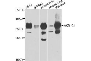 Western blot analysis of extracts of various cell lines, using AKR1C4 antibody. (AKR1C4 Antikörper)