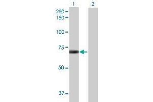 Lane 1: DTX2 transfected lysate ( 68.
