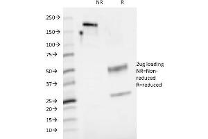 SDS-PAGE Analysis Purified CD48 Mouse Monoclonal Antibody (5-4. (CD48 Antikörper)