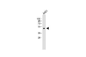 Anti-ATG4D at 1:4000 dilution + A431 whole cell lysate Lysates/proteins at 20 μg per lane.