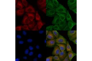 ABIN6256507 and ABIN6267633 staining H2O2 treated Hela cells by IF/ICC.