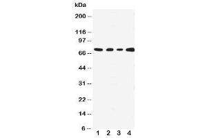 Western blot testing with MEKK3 antibody;  Lane 1: HeLa;  2: A431;  3: MCF-7;  4: Jurkat cell lysate. (MAP3K3 Antikörper  (N-Term))