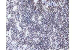 anti-Chromobox Homolog 3 (CBX3) (AA 2-183) antibody