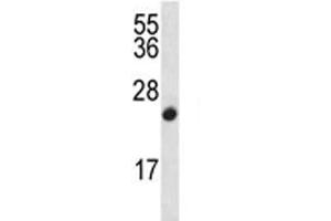 CDKN2B antibody western blot analysis in CEM lysate (CDKN2B Antikörper  (AA 103-131))