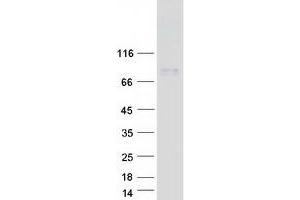Validation with Western Blot (ACCN4 Protein (Transcript Variant 1) (Myc-DYKDDDDK Tag))