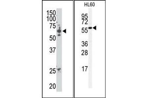 Image no. 1 for anti-SUMO1/sentrin/SMT3 Specific Peptidase 2 (SENP2) (C-Term) antibody (ABIN356752) (SENP2 Antikörper  (C-Term))