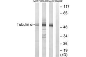 Western blot analysis of extracts from MCF-7/COLO/HepG2 cells, using Tubulin alpha Antibody. (alpha Tubulin Antikörper)