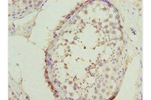 Immunohistochemistry of paraffin-embedded human testis tissue using ABIN7171132 at dilution of 1:100 (SYCE1 Antikörper  (AA 132-351))