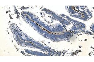 IHC analysis of Coronin 1a/TACO/CORO1A using anti-Coronin 1a/TACO/CORO1A antibody (ABIN7600292).
