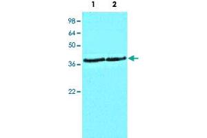 Cell lysates of HeLa (Lane 1) and MCF-7 (Lane 2) (40 ug/lane) were resolved by SDS-PAGE, transferred to NC membrane and probed with CSNK1A1 monoclonal antibody, clone AT2E2  (1 : 1000).