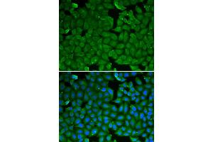 Immunofluorescence analysis of HeLa cells using SPINK1 antibody.
