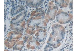 DAB staining on IHC-P; Samples: Human Stomach Tissue (FLG2 Antikörper  (AA 1915-2143))
