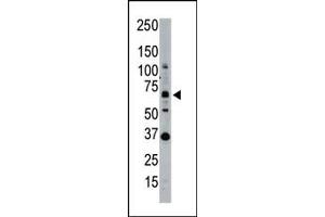 Western blot analysis of SENP1 polyclonal antibody  in whole HL60 cell lysate: SENP1 (Arrow) was detected using purified Pab. (SENP1 Antikörper  (N-Term))