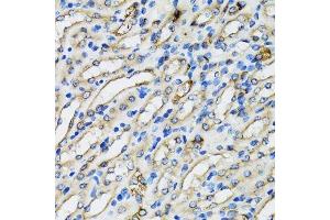 Immunohistochemistry of paraffin-embedded mouse kidney using COPB2 antibody.