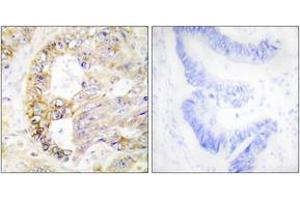 Immunohistochemistry analysis of paraffin-embedded human colon carcinoma tissue, using COX41 Antibody. (COX IV Antikörper  (AA 11-60))