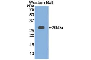 Western blot analysis of the recombinant protein. (CSNK1A1 Antikörper  (AA 114-324))