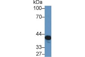 Detection of NAT2 in Rat Serum using Polyclonal Antibody to N-Acetyltransferase 2 (NAT2) (NAT2 Antikörper  (AA 20-280))