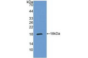 Detection of Recombinant IL5Ra, Human using Polyclonal Antibody to Interleukin 5 Receptor Alpha (IL5Ra) (IL5RA Antikörper  (AA 42-182))