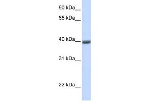 MAGEA1 antibody used at 1 ug/ml to detect target protein. (MAGEA1 Antikörper)