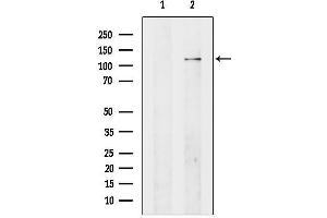 anti-Adenylate Cyclase 4 (ADCY4) (Internal Region) antibody