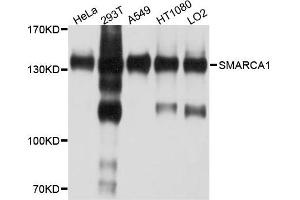 Western blot analysis of extract of various cells, using SMARCA1 antibody. (SMARCA1 Antikörper)