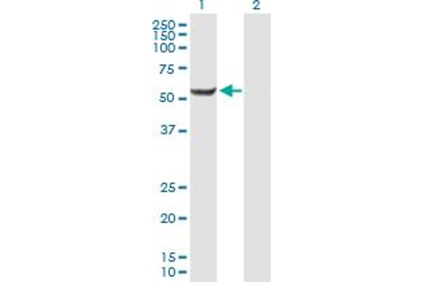 CENPI Antikörper  (AA 1-522)