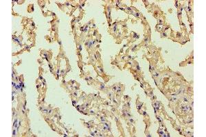 Immunohistochemistry of paraffin-embedded human lung tissue using ABIN7145166 at dilution of 1:100 (Cyclin D1 Antikörper  (AA 1-233))