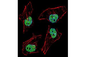 Fluorescent confocal image of Hela cell stained with NFYB Antibody (N-term). (NFYB Antikörper  (N-Term))