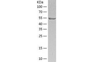 Ubiquitin Specific Peptidase 14 (USP14) (AA 1-494) protein (His-IF2DI Tag)
