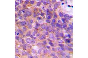 Immunohistochemistry (IHC) image for anti-Potassium Voltage-Gated Channel, Shaker-Related Subfamily, beta Member 3 (KCNAB3) (C-Term) antibody (ABIN7297556)