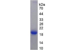 SDS-PAGE analysis of Rat Keratin 12 Protein.