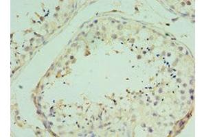 Immunohistochemistry of paraffin-embedded human testis tissue using ABIN7172205 at dilution of 1:100 (TICAM2 Antikörper  (AA 1-235))