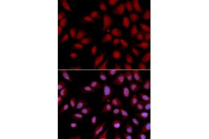 Immunofluorescence analysis of U2OS cells using DLGAP5 antibody. (DLGAP5 Antikörper)