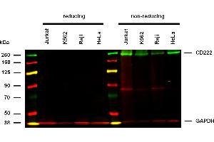 Anti-Hu CD222 Purified (clone MEM-238) works in WB application under non-reducing conditions. (IGF2R Antikörper)