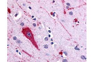 Immunohistochemical (Formalin/PFA-fixed paraffin-embedded sections) staining in human brain (cortex) with HTR5A polyclonal antibody . (Serotonin Receptor 5A Antikörper)