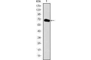 Western blot analysis using GATA5 mAb against human GATA5 (AA: 168-391) recombinant protein.