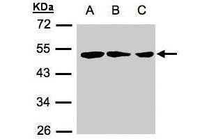 WB Image Sample(30 μg of whole cell lysate) A:239T B:A431 C:H1299 12% SDS PAGE antibody diluted at 1:500 (ZMYND10 Antikörper  (C-Term))