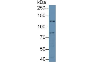 Western blot analysis of Mouse Heart lysate, using Mouse NOS2 Antibody (2 µg/ml) and HRP-conjugated Goat Anti-Rabbit antibody (