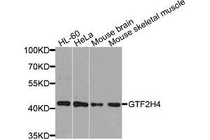 Western blot analysis of extracts of various cells, using GTF2H4 antibody. (GTF2H4 Antikörper)