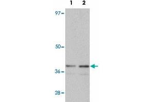 Western blot analysis of SLC39A1 in mouse kidney tissue lysate with SLC39A1 polyclonal antibody  at (1) 1 and (2) 2 ug/mL. (SLC39A1 Antikörper  (N-Term))