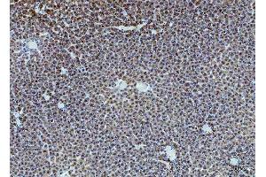 IHC analysis of ARG1 using anti-ARG1 antibody (ABIN6719532).